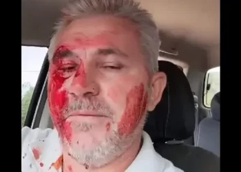 Jornalista esfaqueado por vereador do PT teme ser assassinado