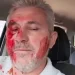 Jornalista esfaqueado por vereador do PT teme ser assassinado