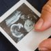 LDO: Lula veta proibição de gastos com aborto e mudança de sexo
